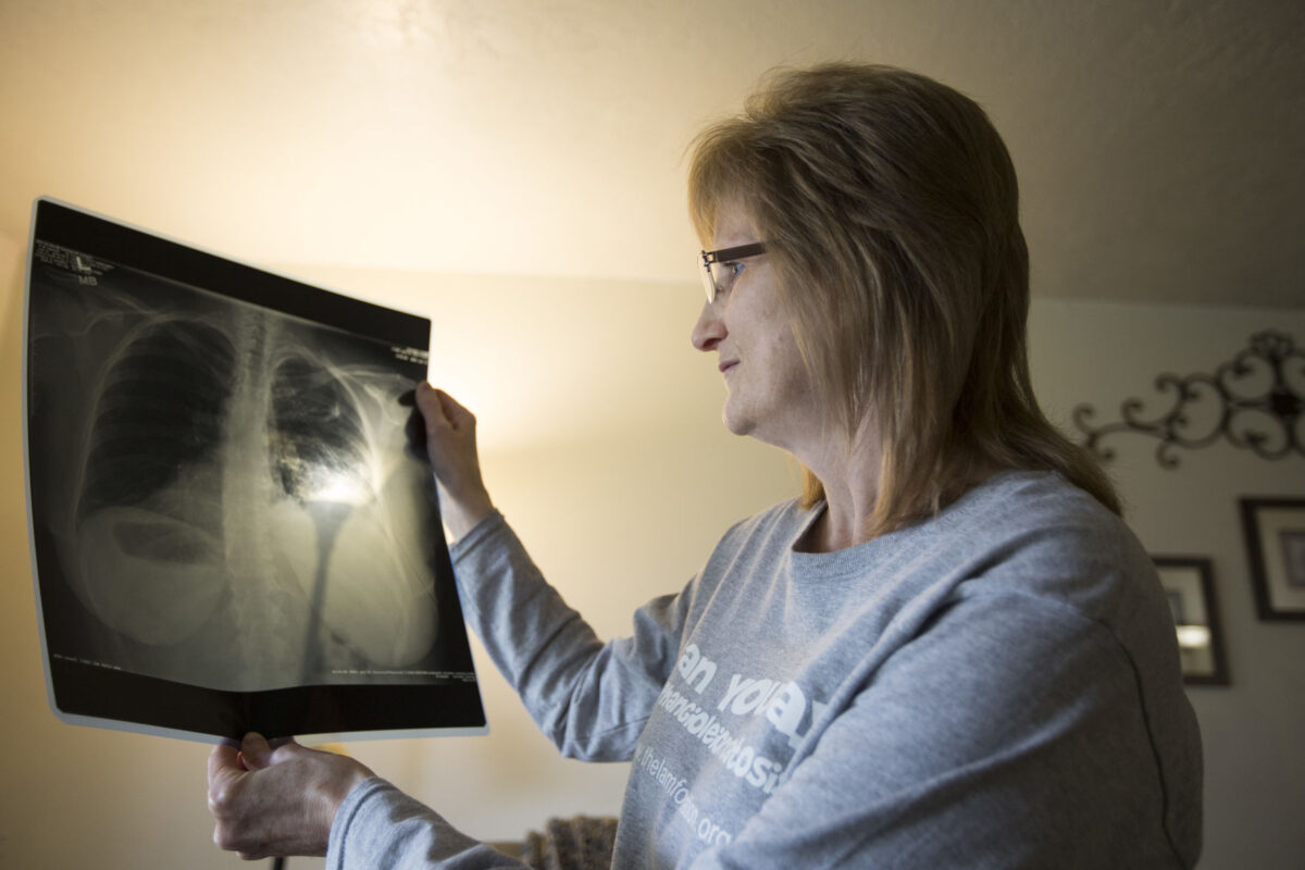 woman-with-rare-terminal-lam-disease-spends-life-helping-others-news